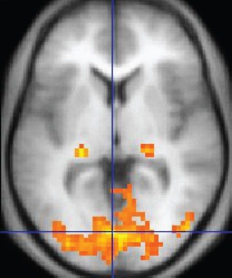 fMRI mozgu.