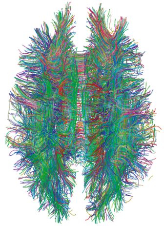 Estimating the Confidence Level of White Matter Connections Obtained with MRI Tractography