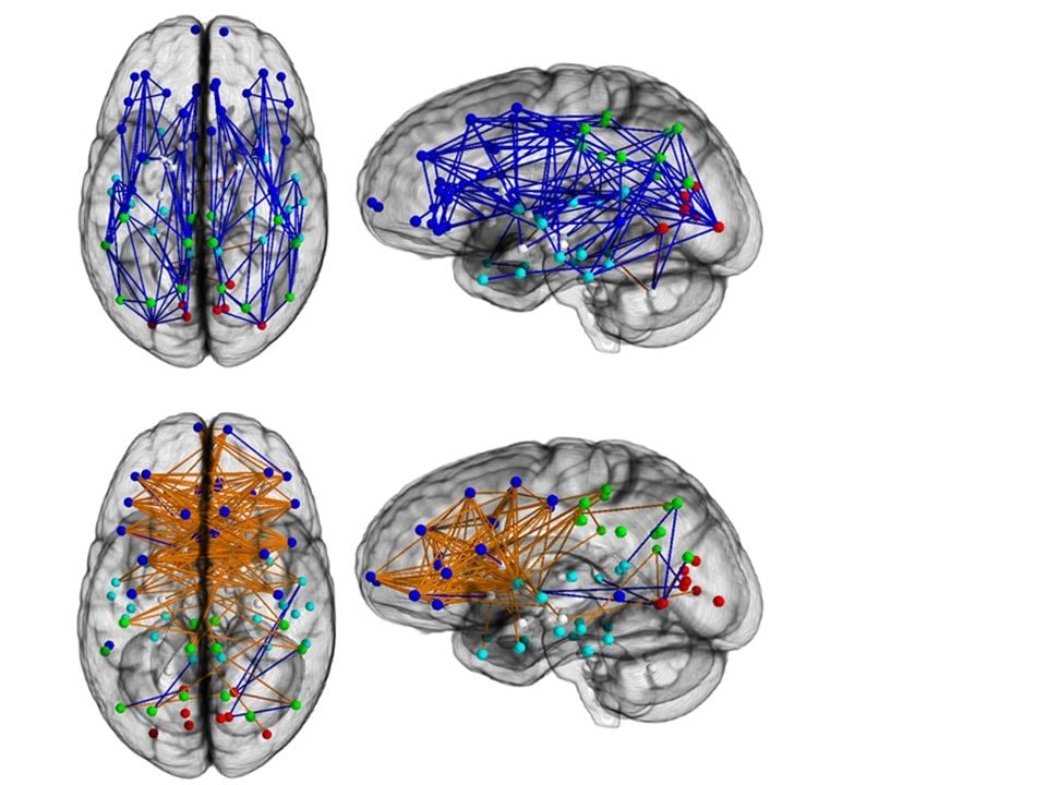 Brain networks show increased connectivity from front to back and within one hemisphere in males (upper) and left to right in females (lower). 