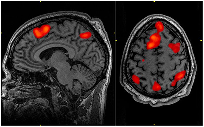 fMRI scans