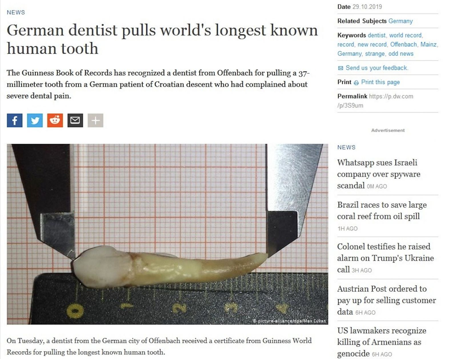 Zubár vytiahol pacientovi skoro 4-centrimetrový zub. Zapísal sa do Guinnessovej knihy rekordov