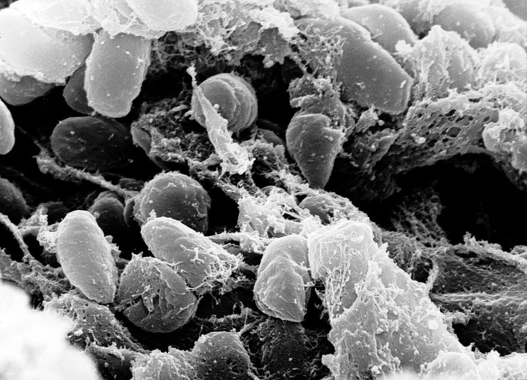Od moru ke koronaviru. Karanténa je nejúčinnějším lékem proti rozšiřování chorob už od 14. století